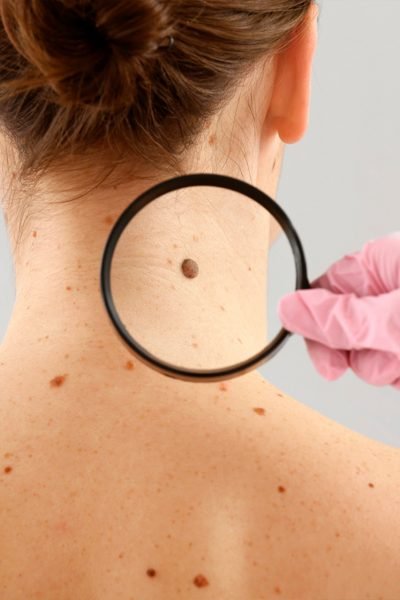 Mohs_Easy-Resize.com